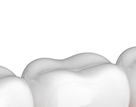 종각치과 너무 많은 치과 치료가 헷갈린다면? 관련 이미지 13