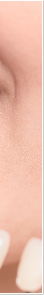 광화문치과 라미네이트 치료 전 고민해야 할 것 관련 이미지 32