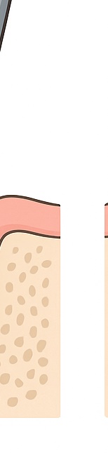 종각치과 임플란트 치료 후 관리 관련 이미지 11