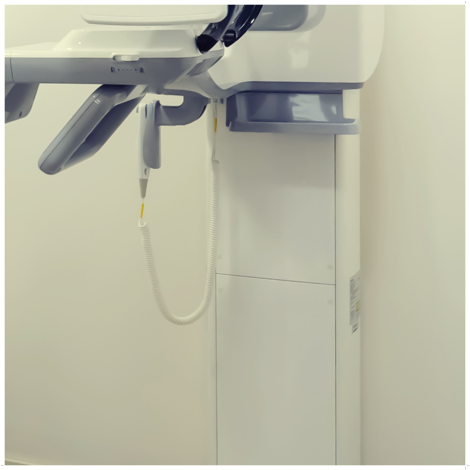 종로치과 마무리까지 확실하게 관련 이미지 36