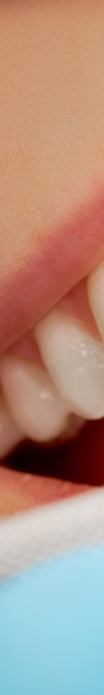 광화문치과 치아미백 그 후 관련 이미지 10