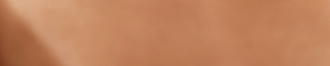 [종각치과] 종각 직장인을 위한 인비절라인 치료 가이드 설명 관련 이미지 31