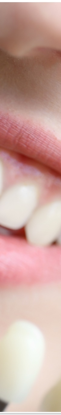 광화문역치과 생활습관에 따른 맞춤형 미백 관리 관련 이미지 32