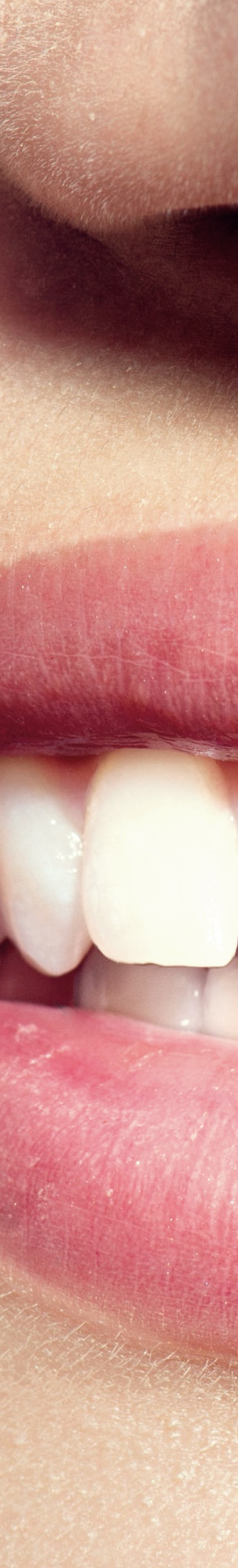 광화문역치과 치아미백과 라미네이트의 차이는? 관련 이미지 6