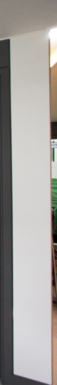 광화문역치과 치아 상실에 임플란트가 필요한 이유 관련 이미지 27