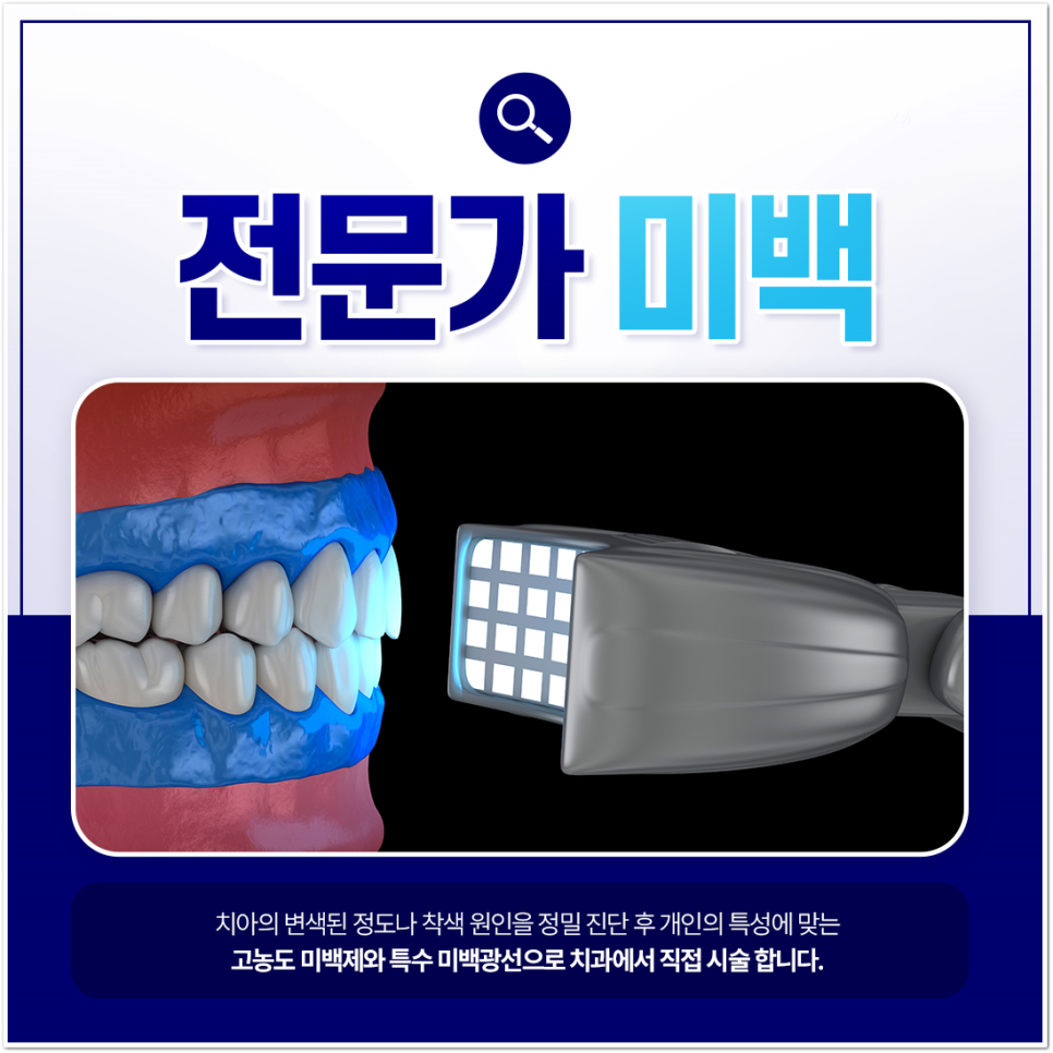 명동역치과 치아 미백, 궁금했던 모든 것 - 오해와 진실 관련 이미지 4