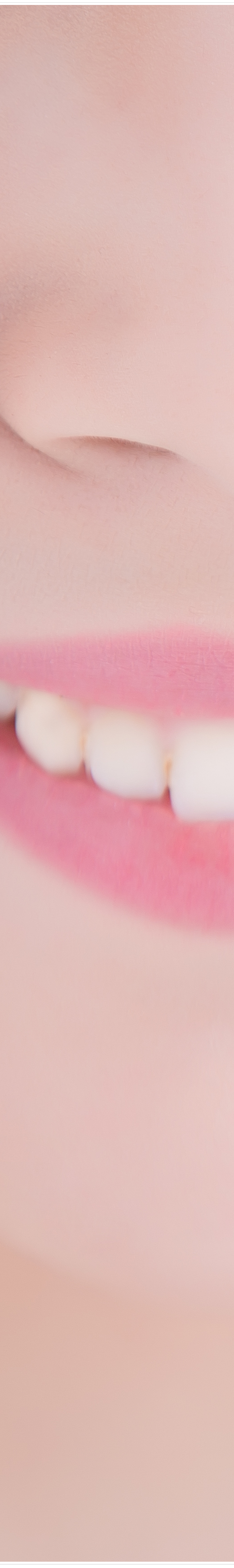 명동치과 라미네이트로 환하게 스마일~ 관련 이미지 10