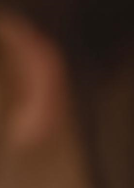 Laminate Veneers Explained by Jonggak Station Dental Clinic: Treatment Duration, Candidates, Benefits, and Everyday Changes image 26