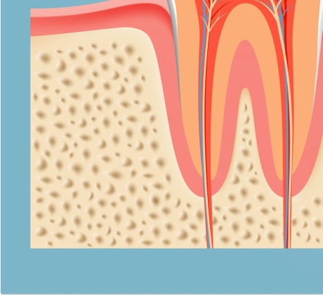 종로치과 충치가 생겼을 때 어떻게 치료 받아야 하나요? 관련 이미지 16