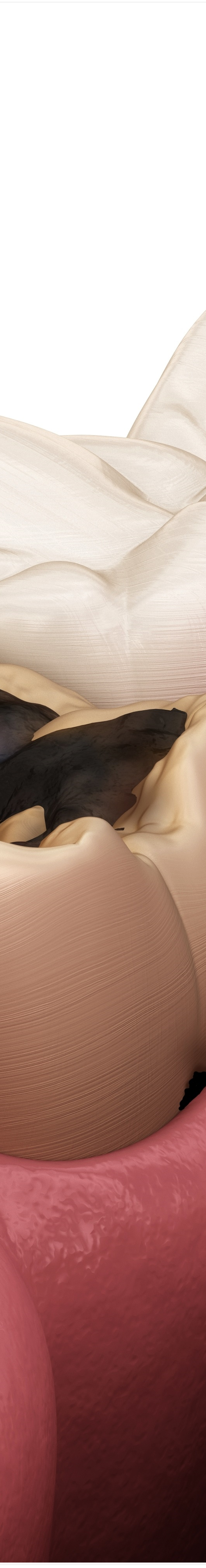 명동치과 치아가 욱씬욱씬 아프신가요? 관련 이미지 35