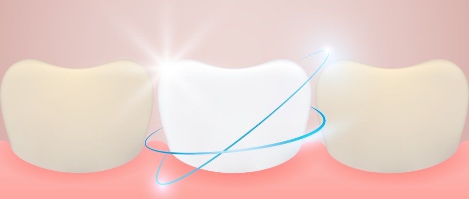 종각역치과, 치아미백 후 48시간을 주의하라! 관련 이미지 7