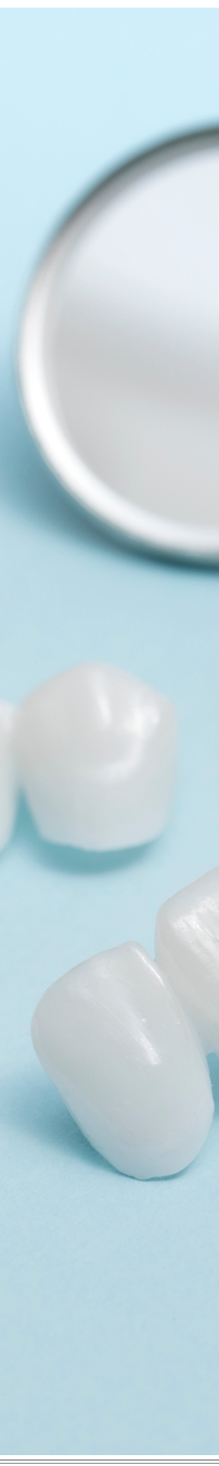 광화문역치과 치아미백과 라미네이트 나에게 필요한 건? 관련 이미지 40