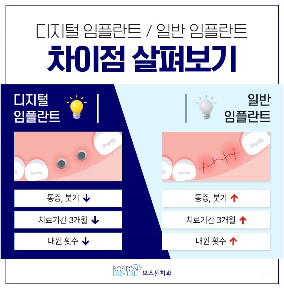 종각치과 임플란트 하나를 심더라도 신중하게 관련 이미지 6