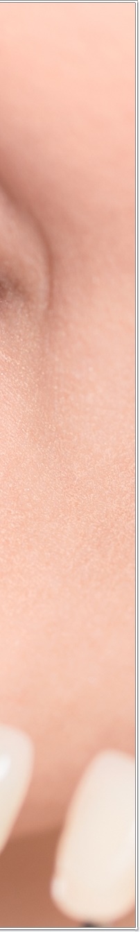 명동치과 치아 라미네이트의 모든 것: 앞니부터 어금니까지 관련 이미지 26