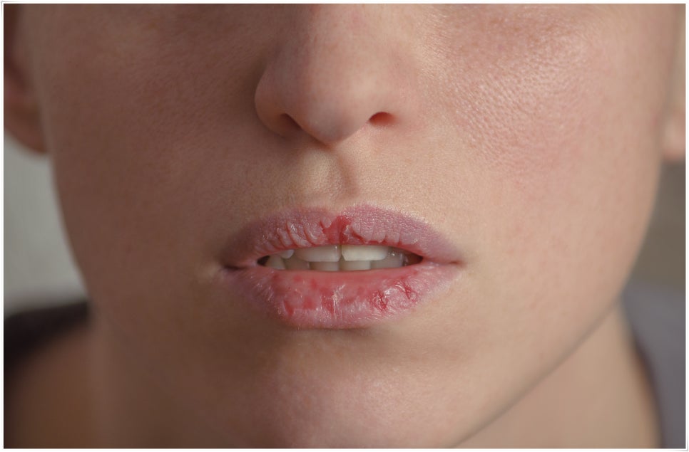 노화가 치아 건강에 영향을 미치나요? 관련 이미지 4