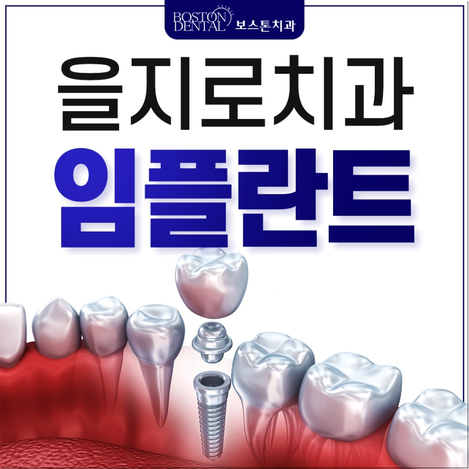 을지로치과 임플란트, 치아가 빠졌다면 어떻게 해야 할까요? 관련 이미지 1