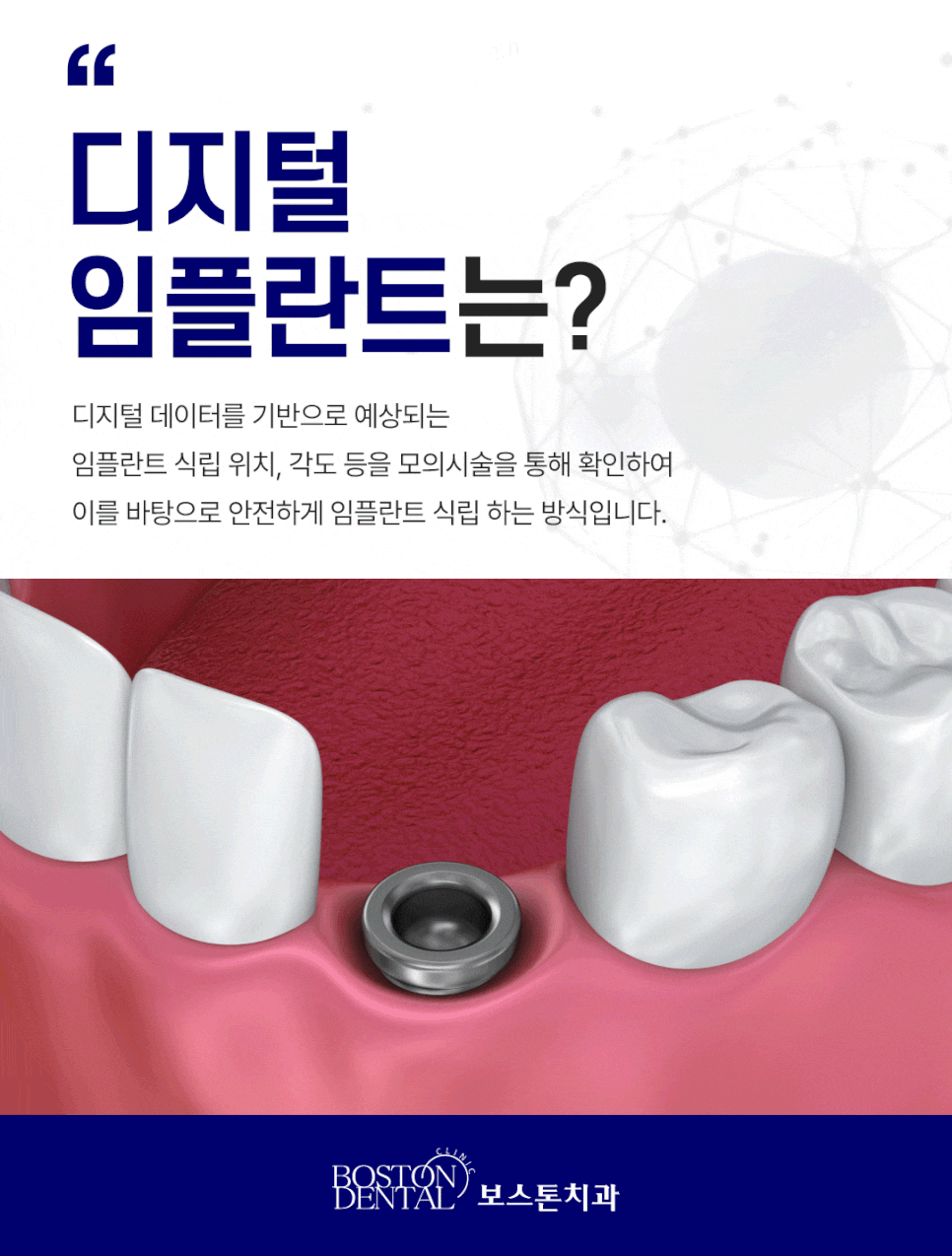 종각역치과 점심시간 이용해서 치과 치료 받아보세요 관련 이미지 5