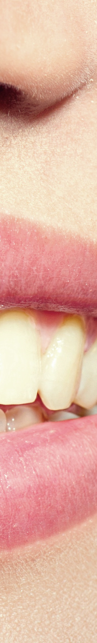 광화문역치과 치아미백과 라미네이트의 차이는? 관련 이미지 9