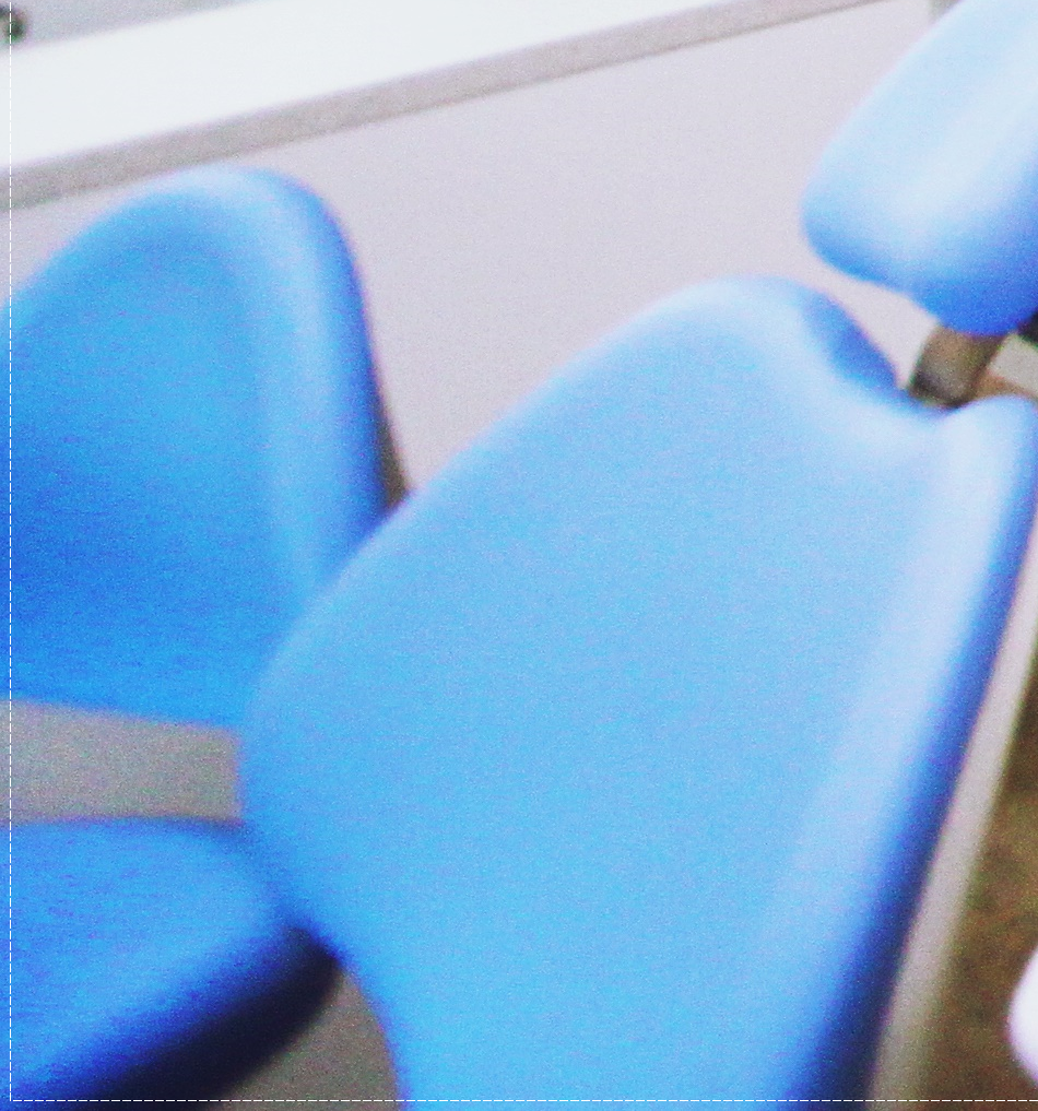 을지로치과 투명해서 티가 안 나게 교정할 수 있어요 관련 이미지 40