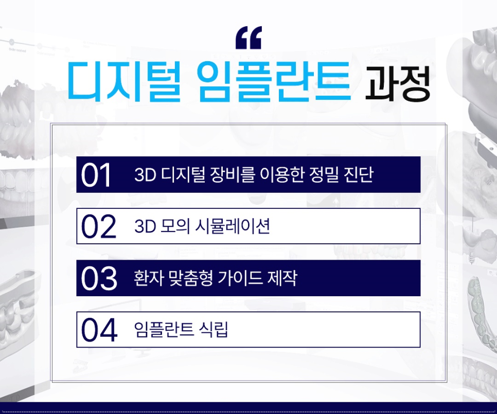 종각역치과 임플란트 치료, 이것만은 알고 계세요! 관련 이미지 5