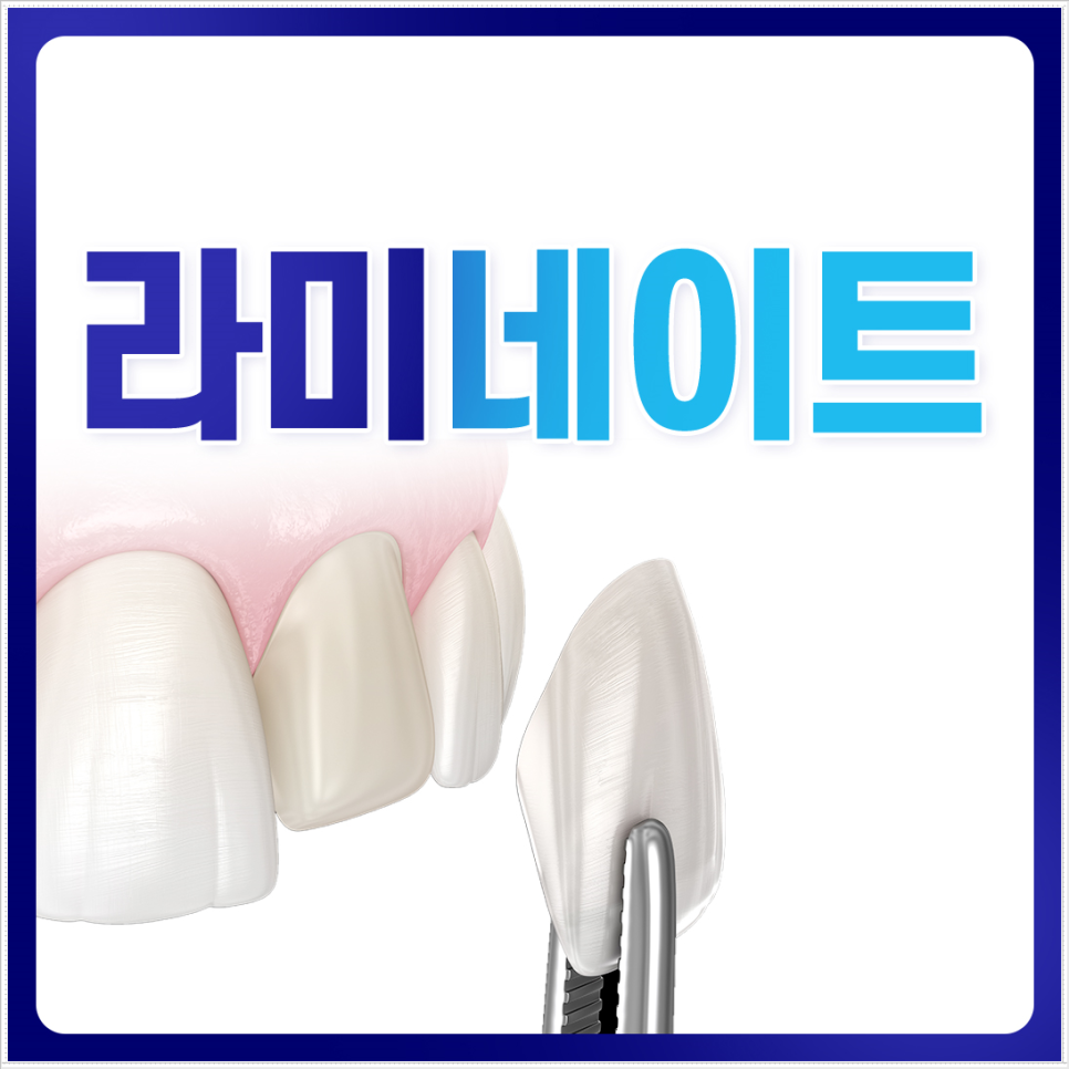 종로치과 자연스러운 라미네이트 색, 얼마나 하얘야 예쁠까? 관련 이미지 5