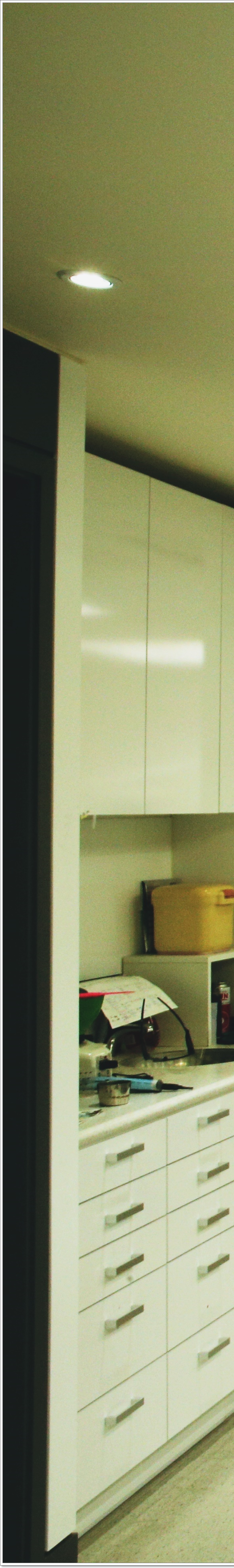 명동치과 상실부위는 임플란트로 관련 이미지 30