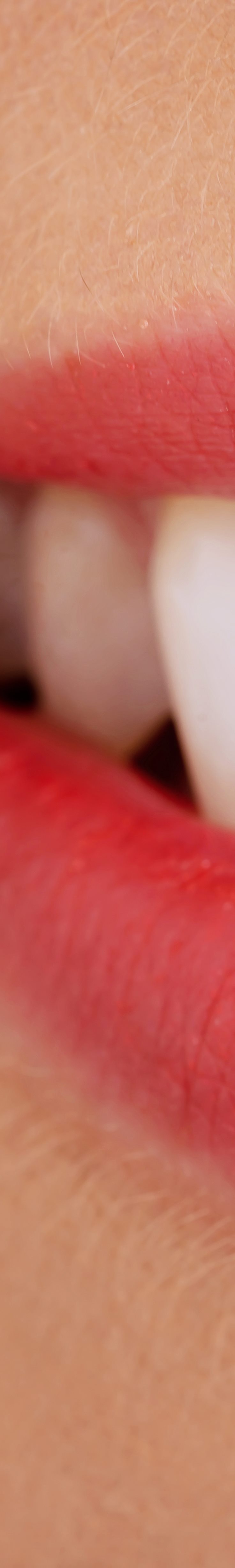 [종각역치과] 치아가 누렇게 보이는 진짜 이유, 미백 전에 꼭 알아야 할 것들 관련 이미지 10