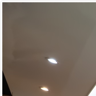 종각치과의 치아미백으로 하얀 미소 찾기 관련 이미지 13