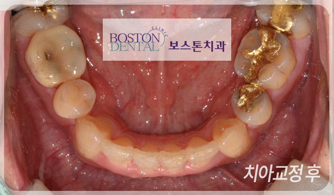 청계천치과 깔끔해요! 관련 이미지 5