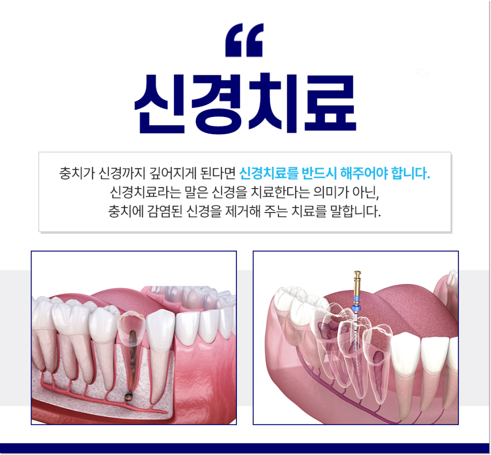 종각치과 너무 많은 치과 치료가 헷갈린다면? 관련 이미지 4