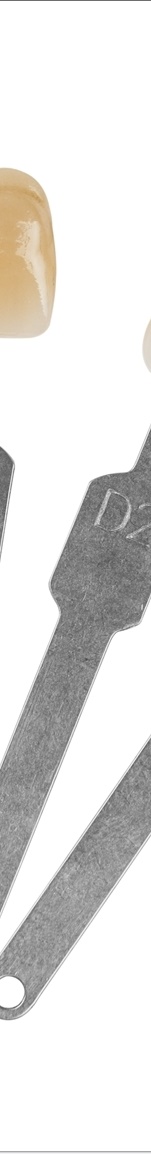 광화문치과 라미네이트 치료 전 고민해야 할 것 관련 이미지 9