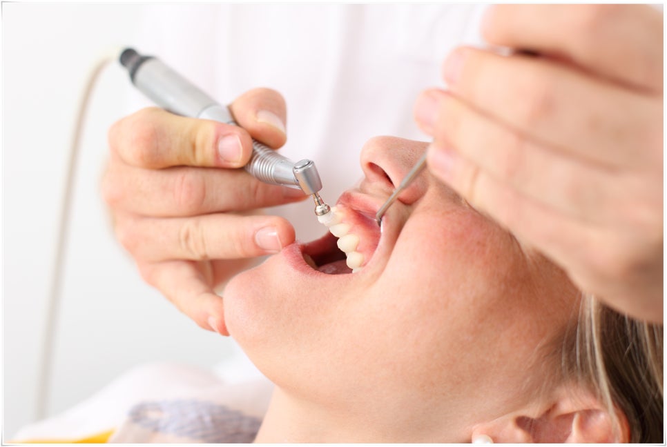 스케일링 하고 나서 주의할 점은? 관련 이미지 4