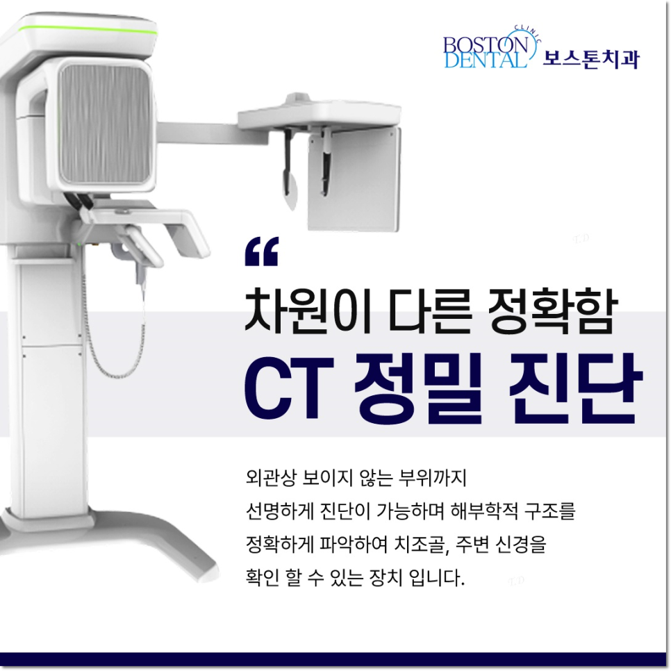 명동치과 상실부위는 임플란트로 관련 이미지 9