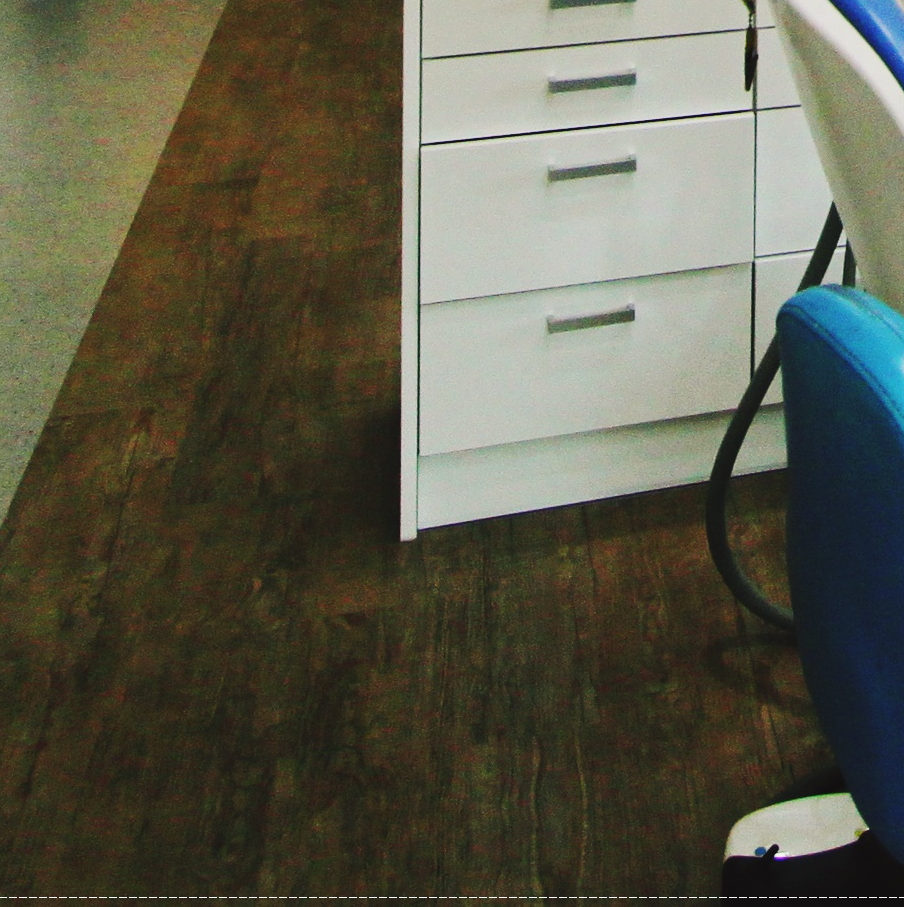 을지로치과 투명해서 티가 안 나게 교정할 수 있어요 관련 이미지 28