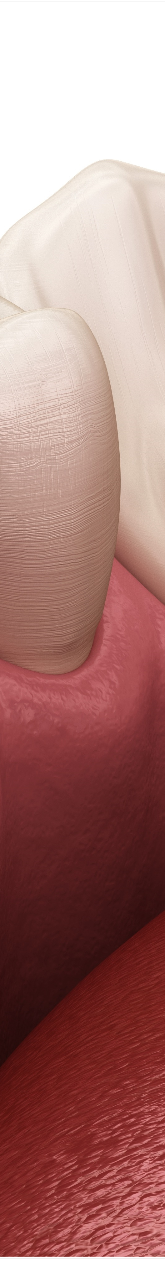 명동치과 치아가 욱씬욱씬 아프신가요? 관련 이미지 37