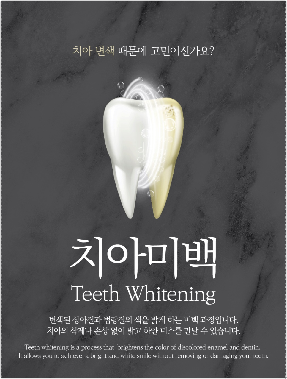 종각역치과 치아미백 효과를 오래 유지하고 싶어요 관련 이미지 4