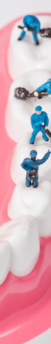 종각역치과 자연치아를 살리기 위한 대책, 신경치료 관련 이미지 25