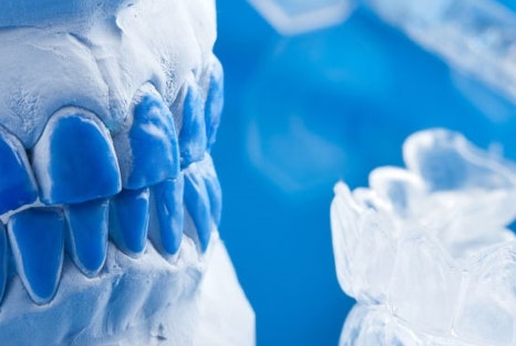 을지로치과 치아미백 후 관리 잘하고 계신가요? 관련 이미지 13