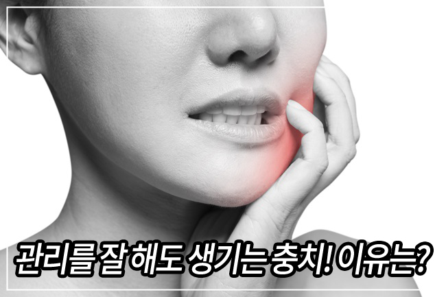 충치는 유전적인 질환?! 관련 이미지 1