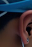 Jongno Dental Implants: Fast and Accurate Treatment Using Digital Technology image 10