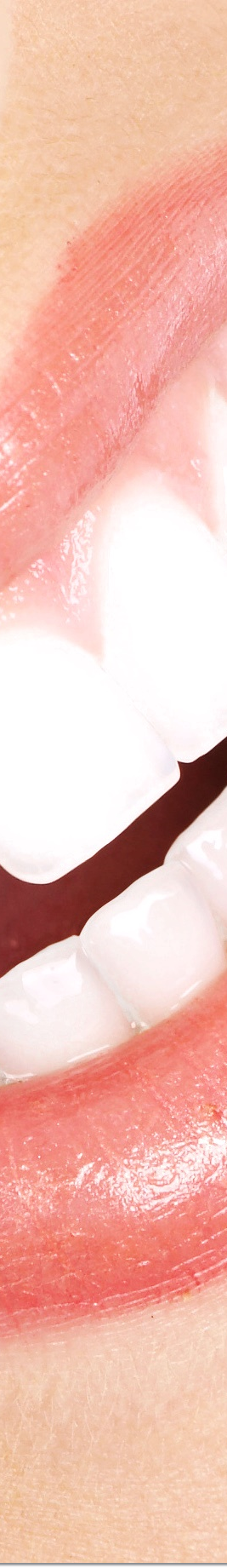 광화문역치과 라미네이트 치료가 궁금해요 관련 이미지 24