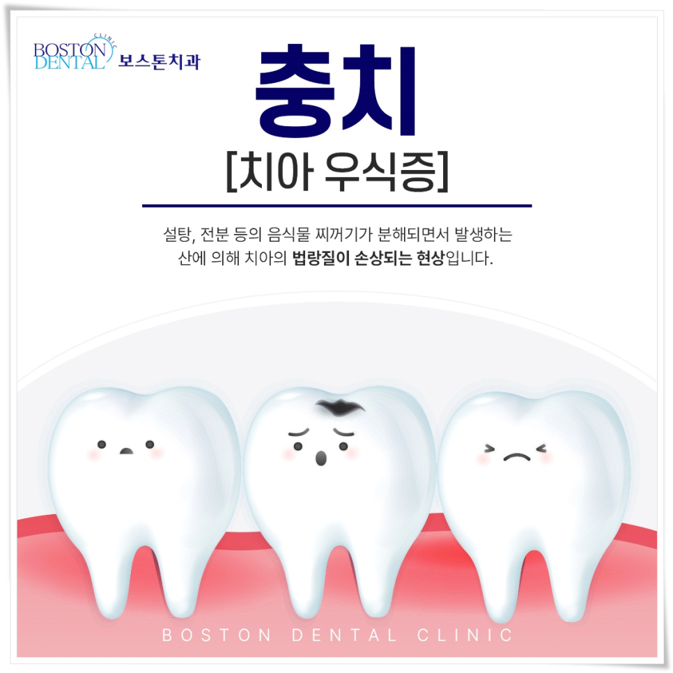 종각역 치과 점심시간에도 편하게 진료 보세요 관련 이미지 1