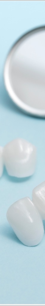 광화문치과 라미네이트 치료 전 고민해야 할 것 관련 이미지 38