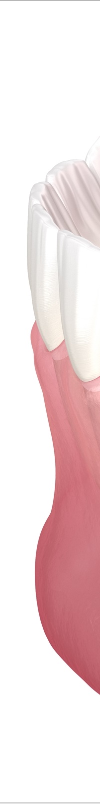 종각역치과 자연치아를 살리기 위한 대책, 신경치료 관련 이미지 9