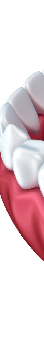 종각역치과 충치를 방치하면 신경치료를 해야 한다. 관련 이미지 8