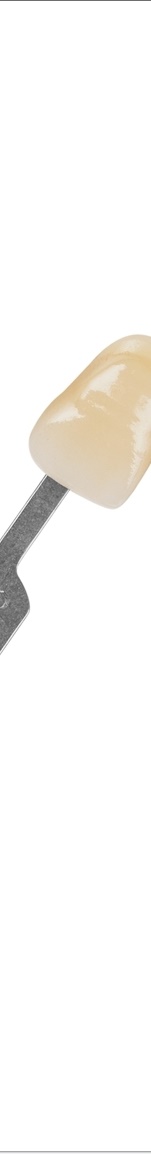 광화문치과 라미네이트 치료 전 고민해야 할 것 관련 이미지 11