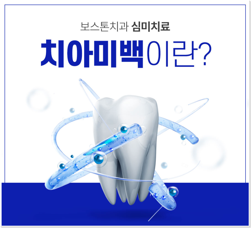 광화문역치과 치아미백과 라미네이트 나에게 필요한 건? 관련 이미지 2
