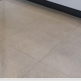 종각치과의 치아미백으로 하얀 미소 찾기 관련 이미지 34