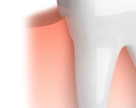 종각치과 너무 많은 치과 치료가 헷갈린다면? 관련 이미지 15