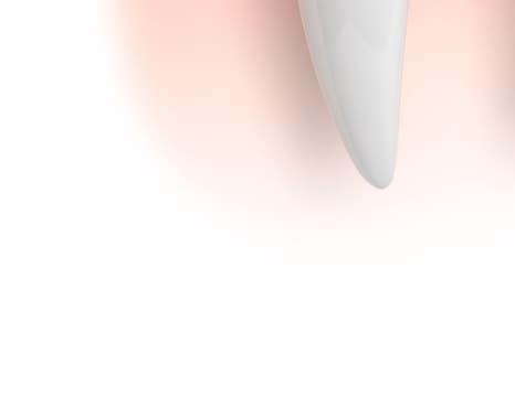 종각치과 너무 많은 치과 치료가 헷갈린다면? 관련 이미지 18